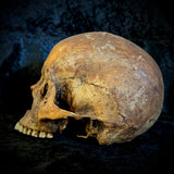 Item 9. Human skull