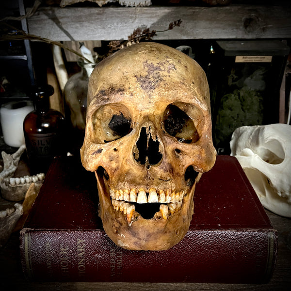 Human skull with mandible