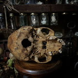 Human skull