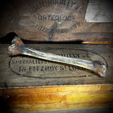 Human tibia (shinbone)