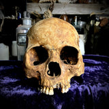 Human skull