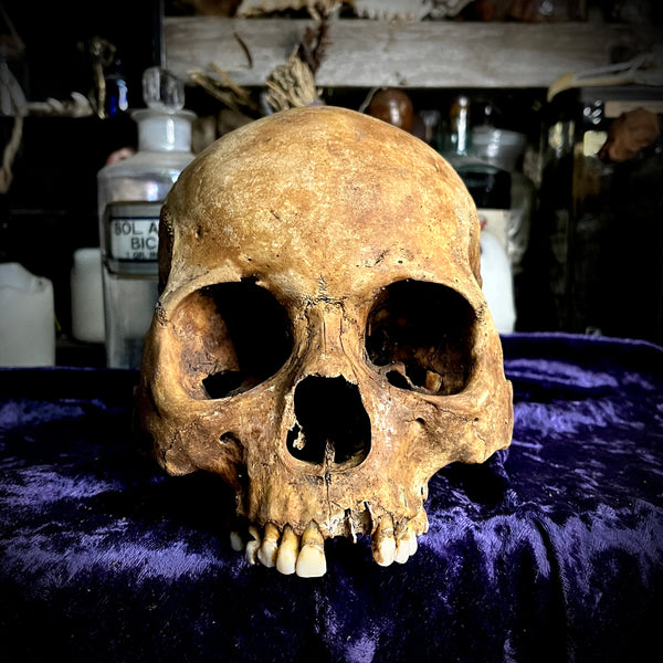 Human skull