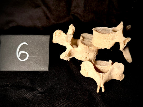 Item 6. Trio of human vertebrae