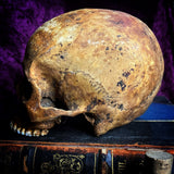 A human skull