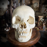 Medically prepared human skull