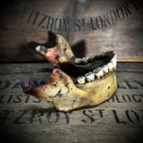 A mandible