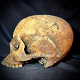 Item 9. Human skull
