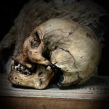 Human skull with mandible
