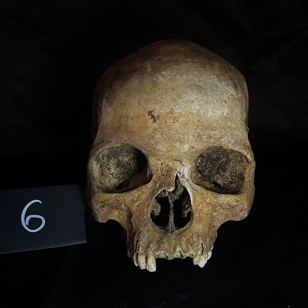 Item 6. Human skull