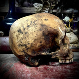 Human skull