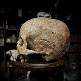 Human Skull