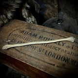 Human fibula (lower leg bone)
