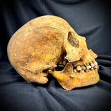 Item 14. Human skull with mandible