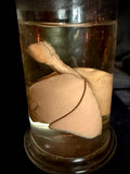 Item 3. Fetal lungs and heart