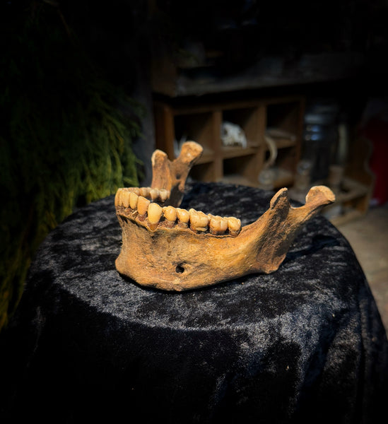 A mandible