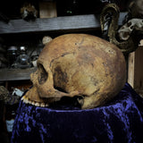 Human skull