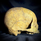 Item 14. Human skull