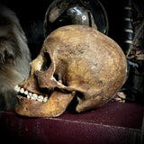 Human skull with mandible