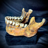 Item 10. Mandible