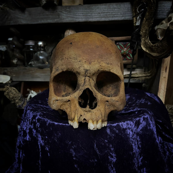 Human skull