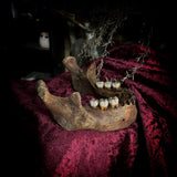 A mandible