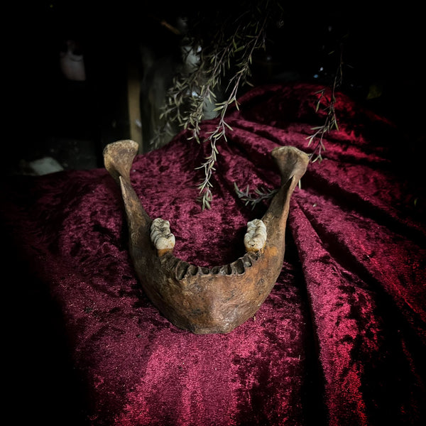 A mandible