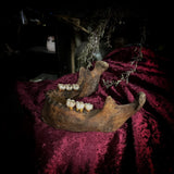 A mandible