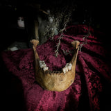 A mandible