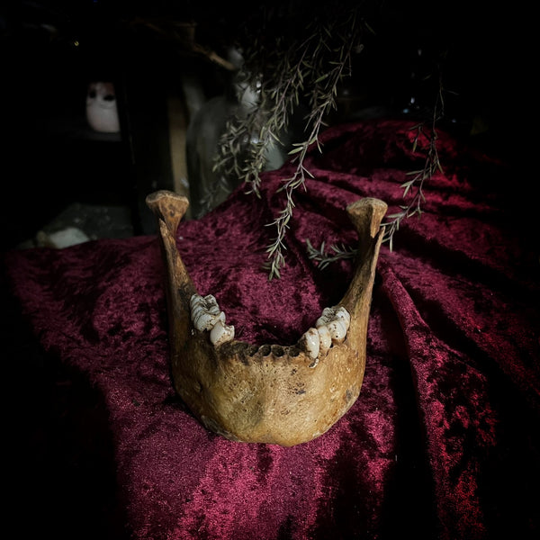 A mandible