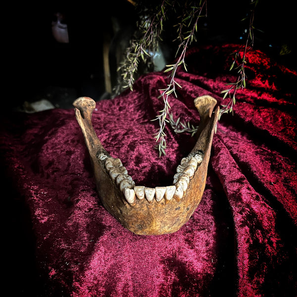 A mandible