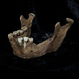 A mandible