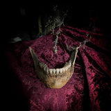 A mandible