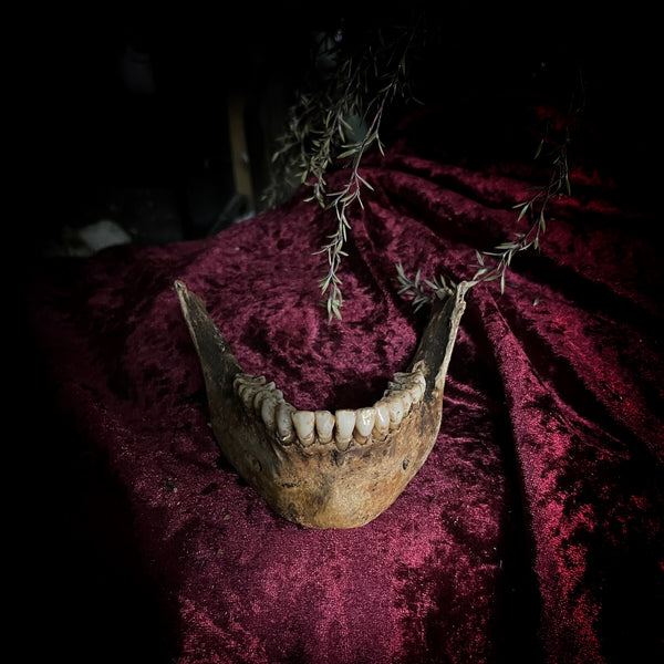 A mandible