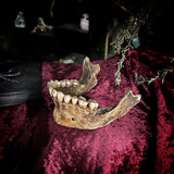 A mandible