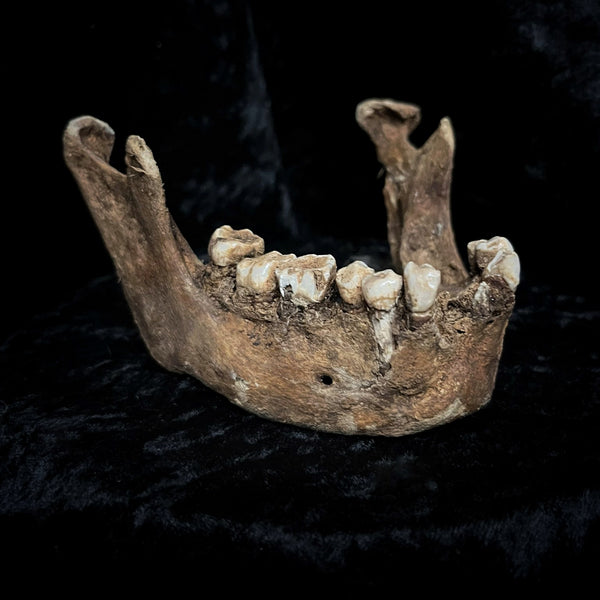 A mandible