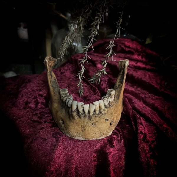 A mandible