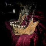 A mandible
