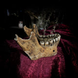 A mandible