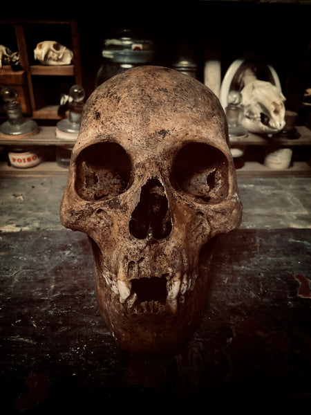 A Human Skull with mandible