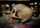 A Human Skull with mandible