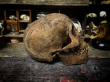 A Human Skull with mandible