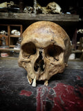 A human skull