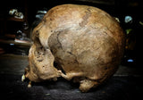 A human skull