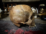 A human skull