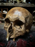 A human skull