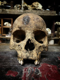 A human skull