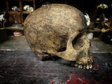 A human skull