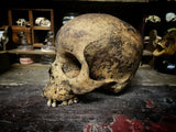 A human skull