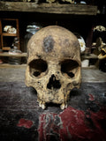 A human skull