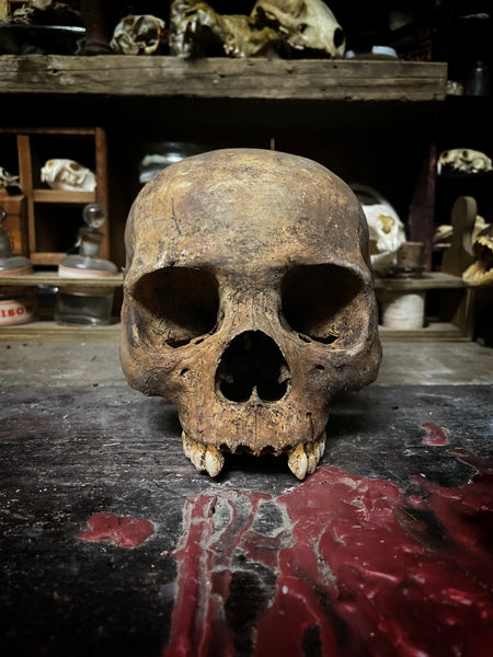A human skull